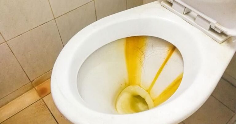 Loại bỏ vế ố vàng bồn cầu vệ sinh