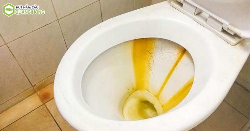 Loại bỏ vế ố vàng bồn cầu vệ sinh